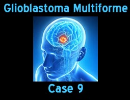 GBM case 9
