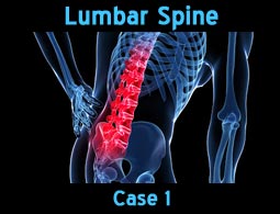 lumbar spine case1