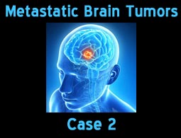 Metastatic case 2