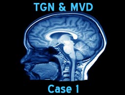 tgn mvd case1