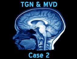 tgn mvd case2