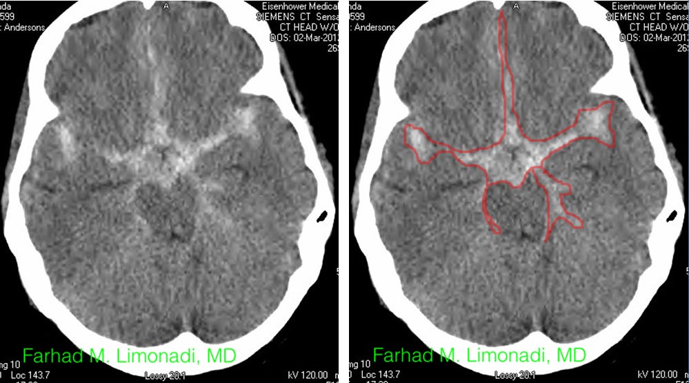 ACOM Case 4 Image 1