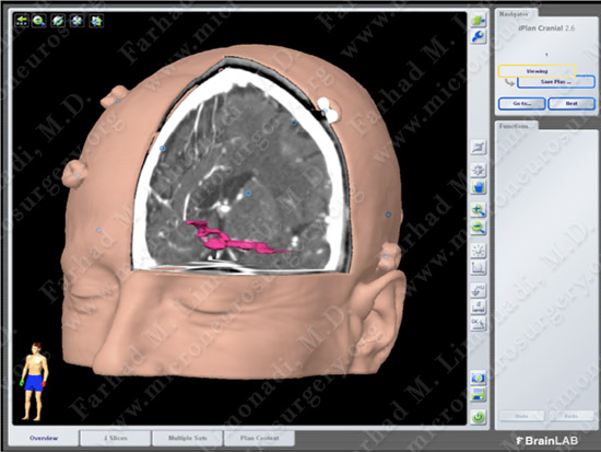 ACOM Case 3 Image 3