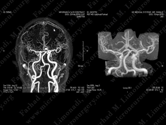 ACOM Case 3 Image 7