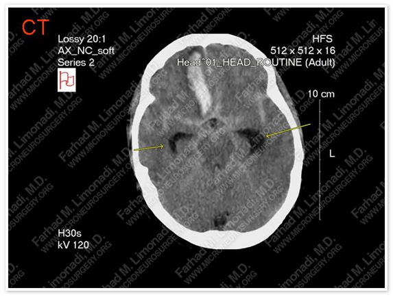 Case 1 Image 1