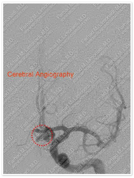 Case 1 Image 4