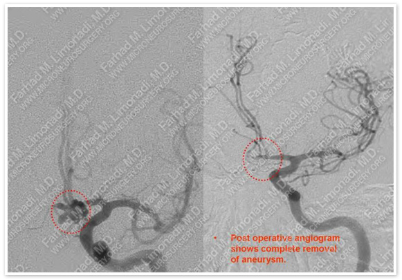 Case 1 Image 5