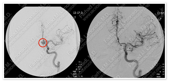 Case 2 Image 3