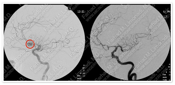 Case 2 Image 4