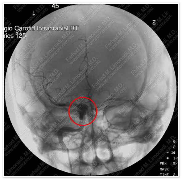 Case 1 Image 1