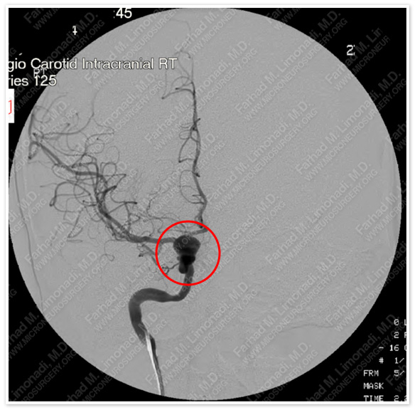 Case 1 Image 4