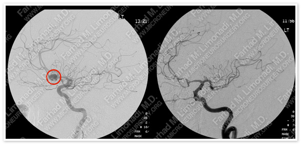 Case 1 Image 7