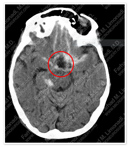 Case 1 Image 1