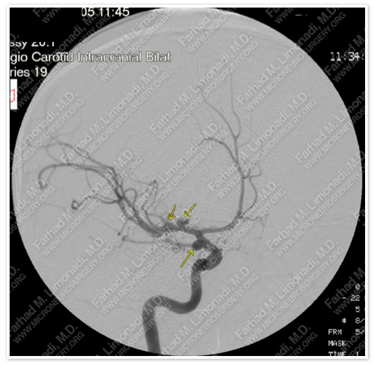 Case 1 Image 2