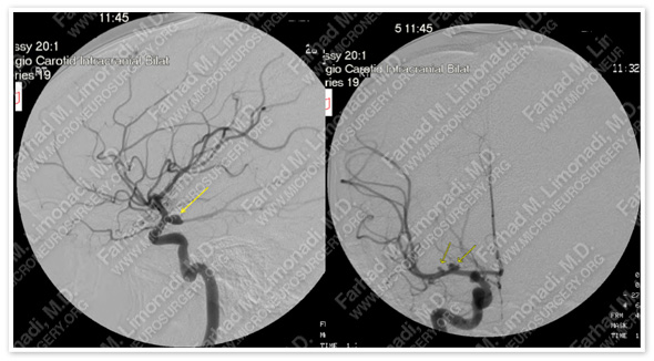 Case 1 Image 3