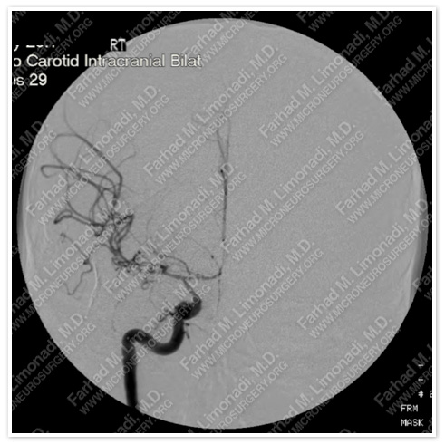 Case 1 Image 4