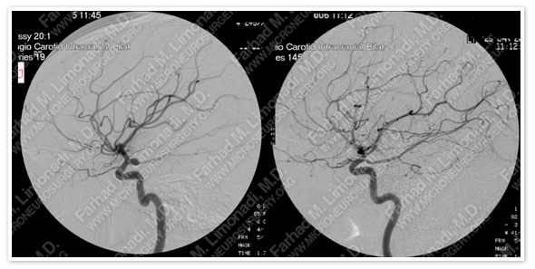 Case 1 Image 5