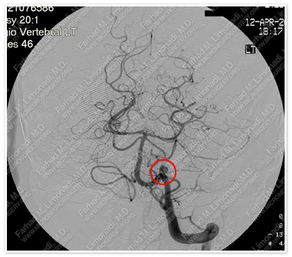 Case 2 Image 4