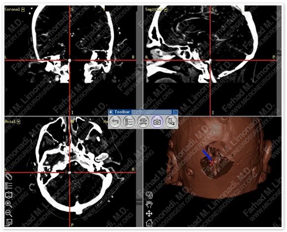 Case 2 Image 6