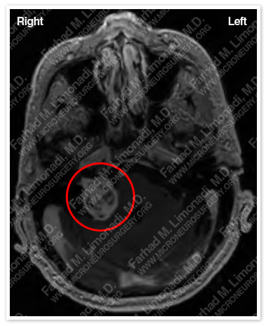 Case 2 Image 1