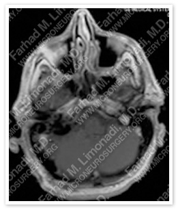 Case 2 Image 6