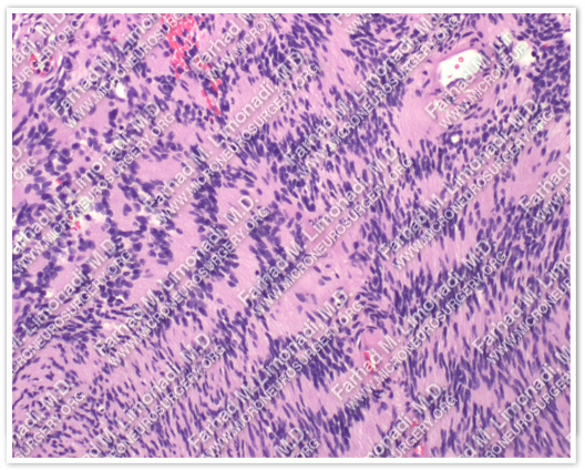 Case 4 Image 6
