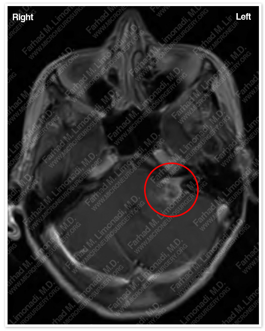 Case 5 Image 2