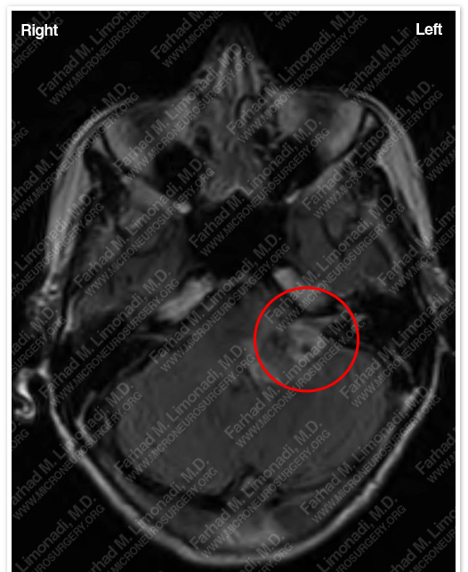 Case 5 Image 4