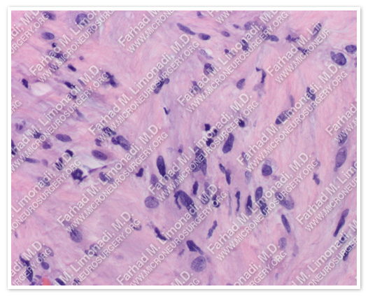 Case 5 Image 5