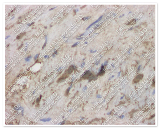 Case 5 Image 6