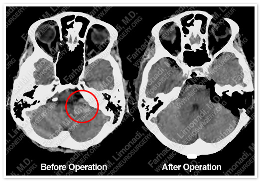 Case 5 Image 7