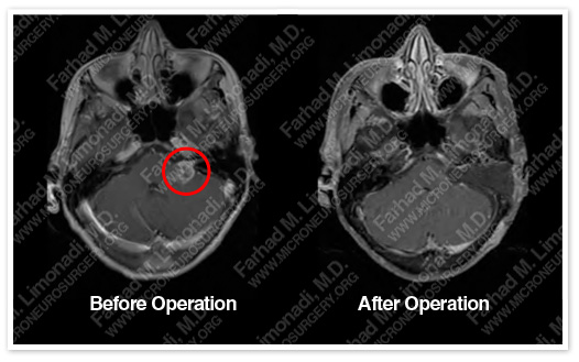 Case 5 Image 8