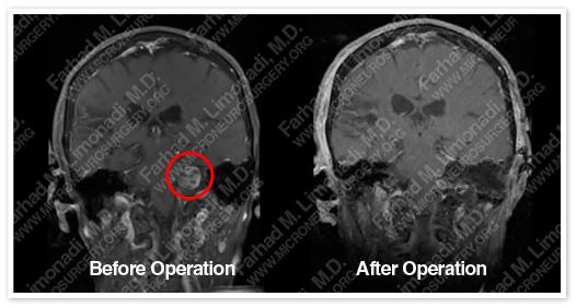 Case 5 Image 9