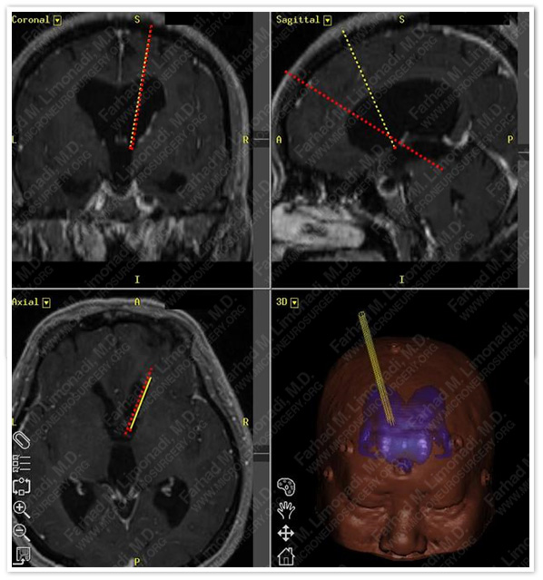 Case 1 Image 3