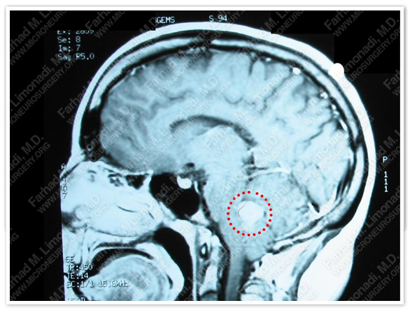 Case 1 Image 1