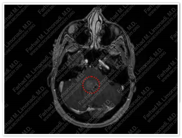 Case 1 Image 2