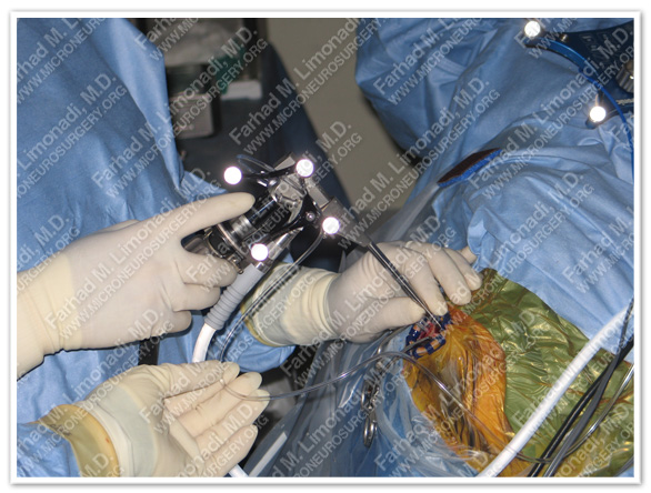 Case 1 Image 3