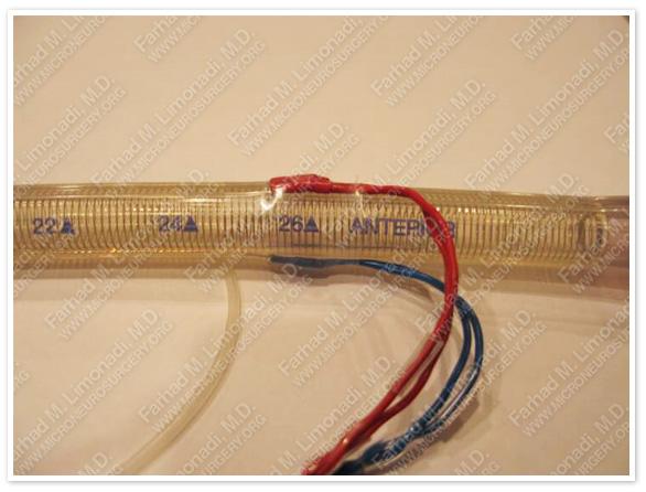 Case 1 Image 6