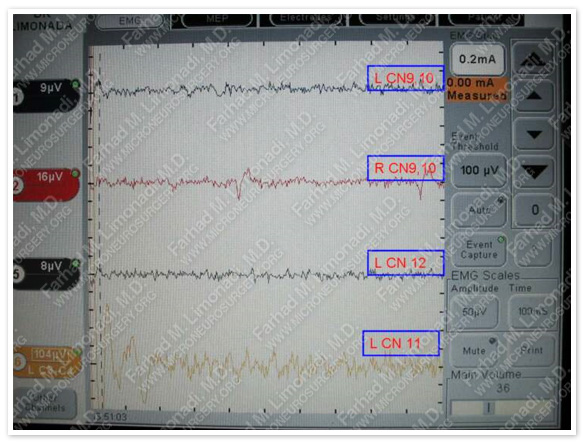 Case 1 Image 7