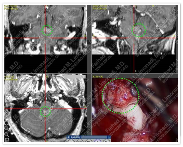 Case 1 Image 8