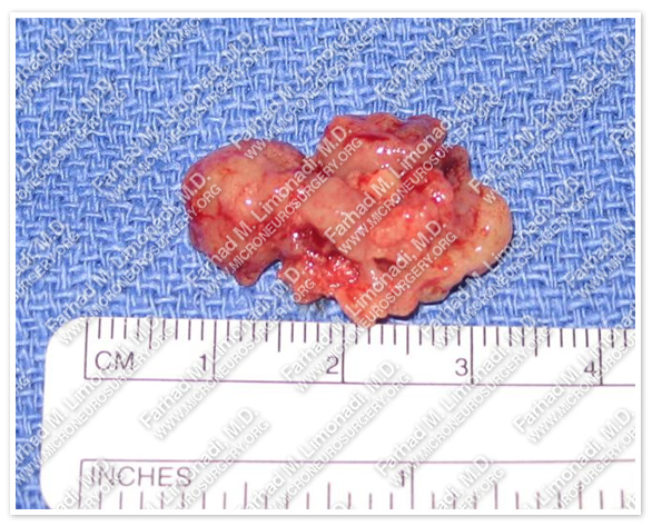 Case 1 Image 9