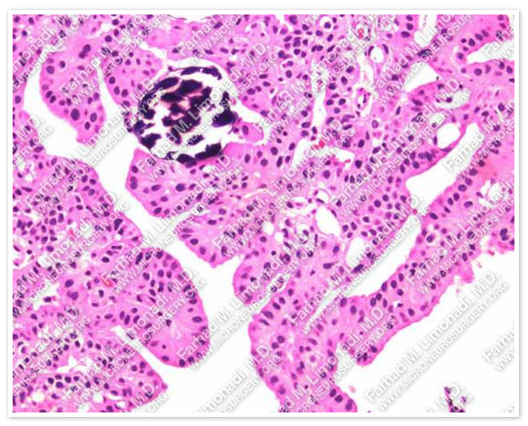 Case 1 Image 10