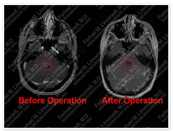 Case 1 Image 11