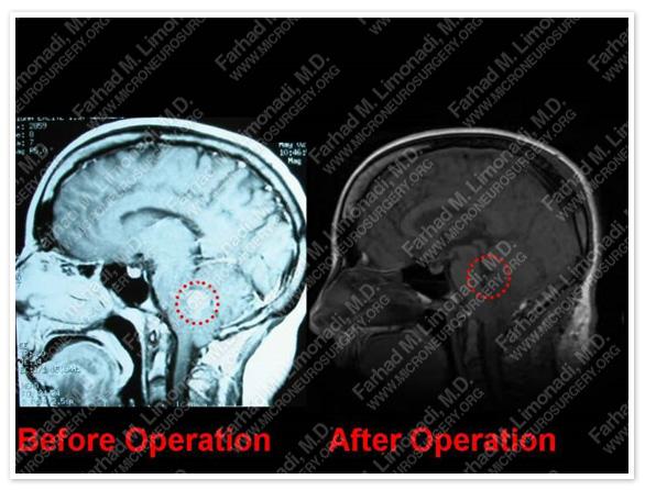 Case 1 Image 12