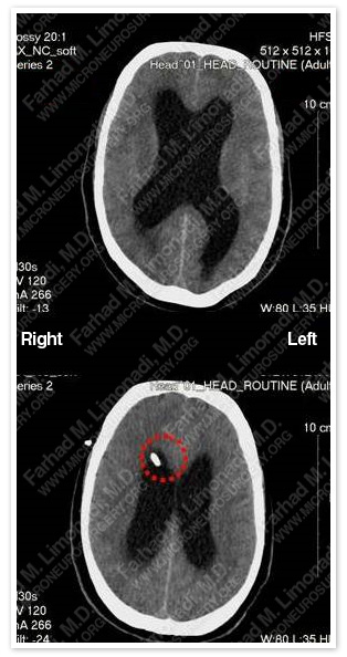 Case 1 Image 1