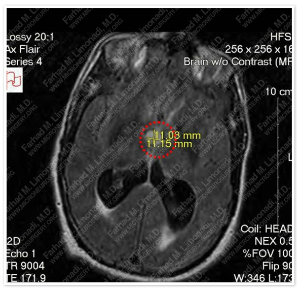 Case 1 Image 2