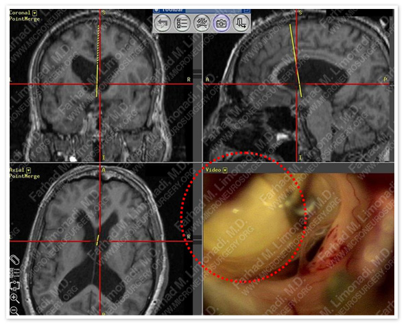 Case 1 Image 3