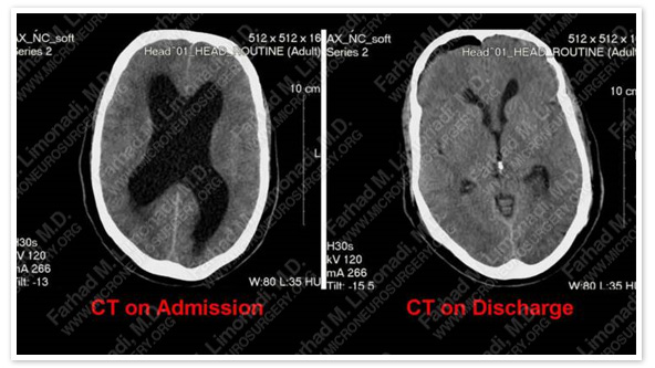 Case 1 Image 4