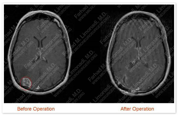 Case 1 Image 3
