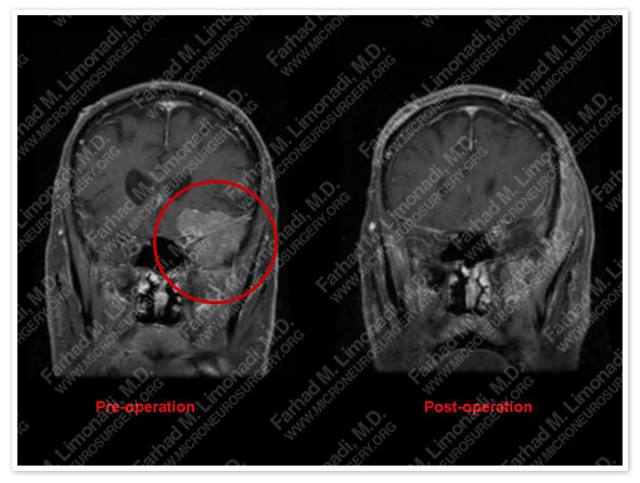 Case 2 Image 1